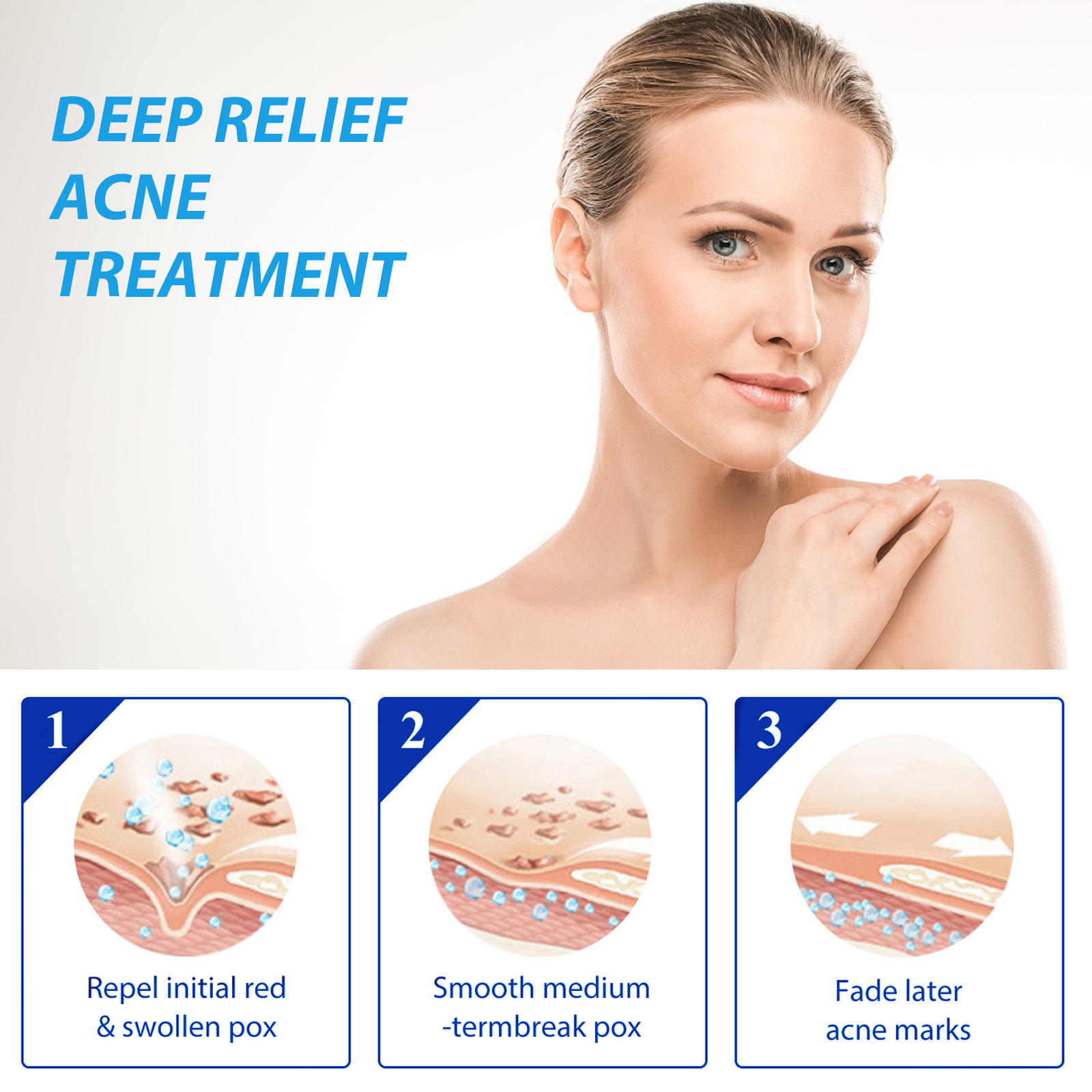 EELHOE-여드름 치료 로션 살리실산 에센스, 주근깨 - Salicylic Acid Blackhead Remover 리뷰 및 가격